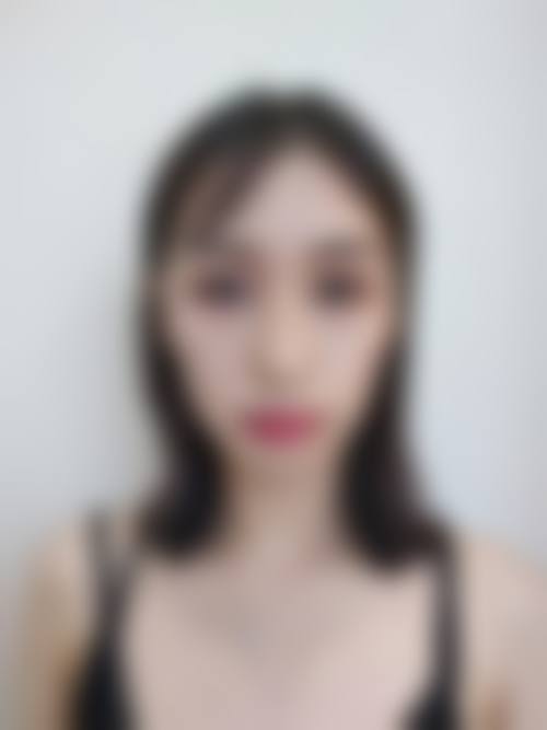 动态分层注射技术：为何3800元起？拆解技术价值