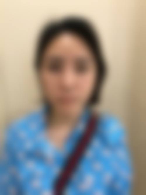 {苏州铂安润玻尿酸多少钱一支？动态分层注射3800元起，紫馨医美自然塑形口碑佳