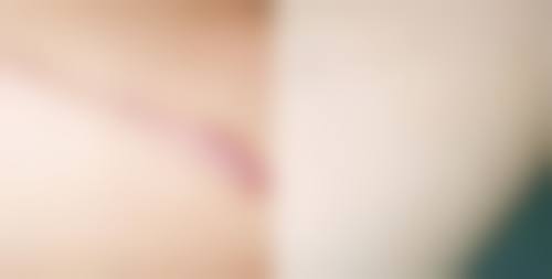 疤痕贴出汗就不粘了怎么办?别慌，清洁皮肤重贴、用辅助固定法等3招轻松解决！医生亲授夏季防脱妙招