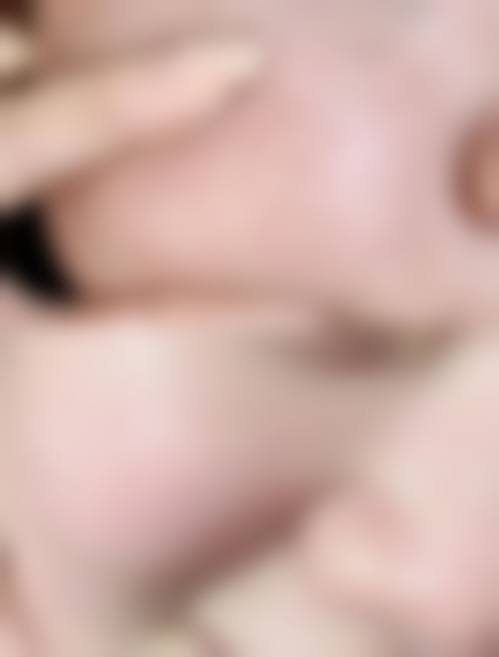 六、聚焦核心：五代热玛吉19800元起，价格为何有差异？