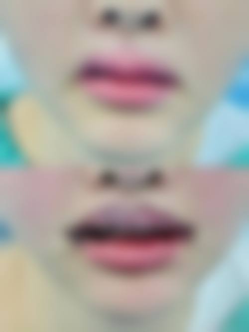 杭州天鑫医美真实实例成效如何？4大项目前后对比超惊艳