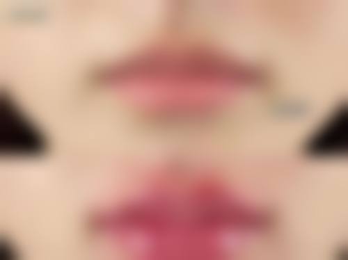 不同医院的北京艾莉薇传奇价格差异