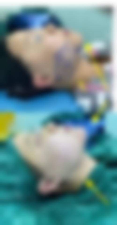 3. 国内人民解放军北部战区总医院整形美容科：三等甲部队医院，临床经验多