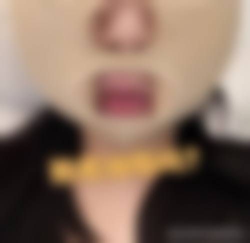 五、想看看真人变化?深扒“上海华美医疗美容医院实例”实拍!