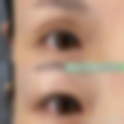 优雅人整形外科正规性如何？韩国保健福祉部认证+1对1诊疗模式双重保护