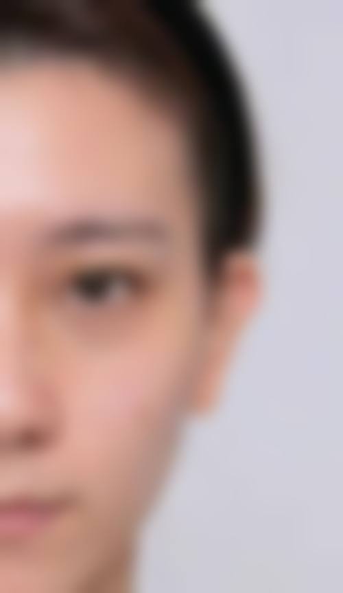 总结：北京打乔雅登玻尿酸一支大概多少钱？收费标准如何，能用医疗保险报销吗？