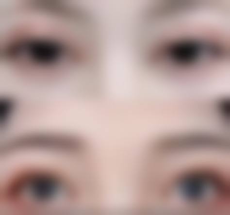 韩国优雅人整形外科医院医生介绍：朴哲佑院长技术亮点全解析