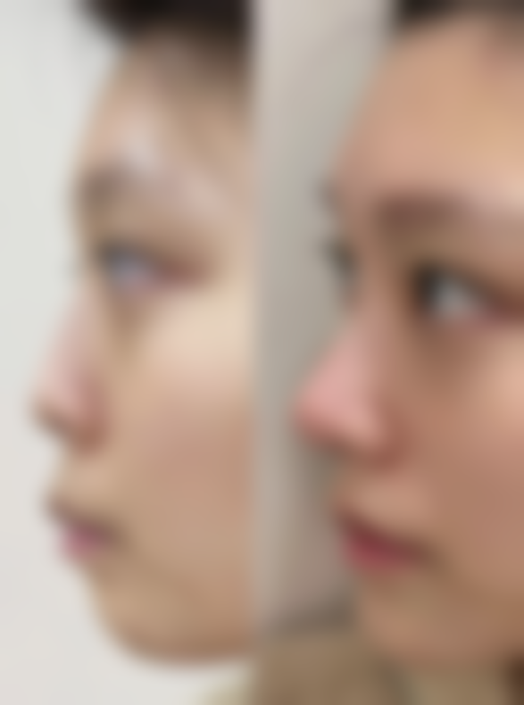 杭州天鑫医美医院是不是正规的?从这几点就能看出来!