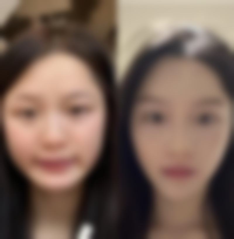 鞍钢总医院-医疗美容医院在线咨询：光子嫩肤、线雕提升多少钱？2026年价目表参考，附官网挂号电话0412-xxx！