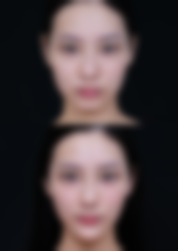 李挺医生的临床经验如何支撑高手术成功几率?