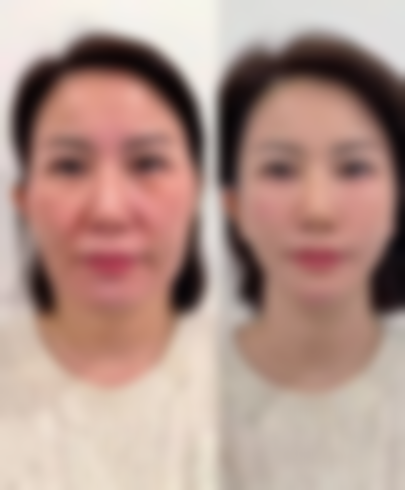 八、从预约到变得更美:你的西 京医院整形之旅全指南