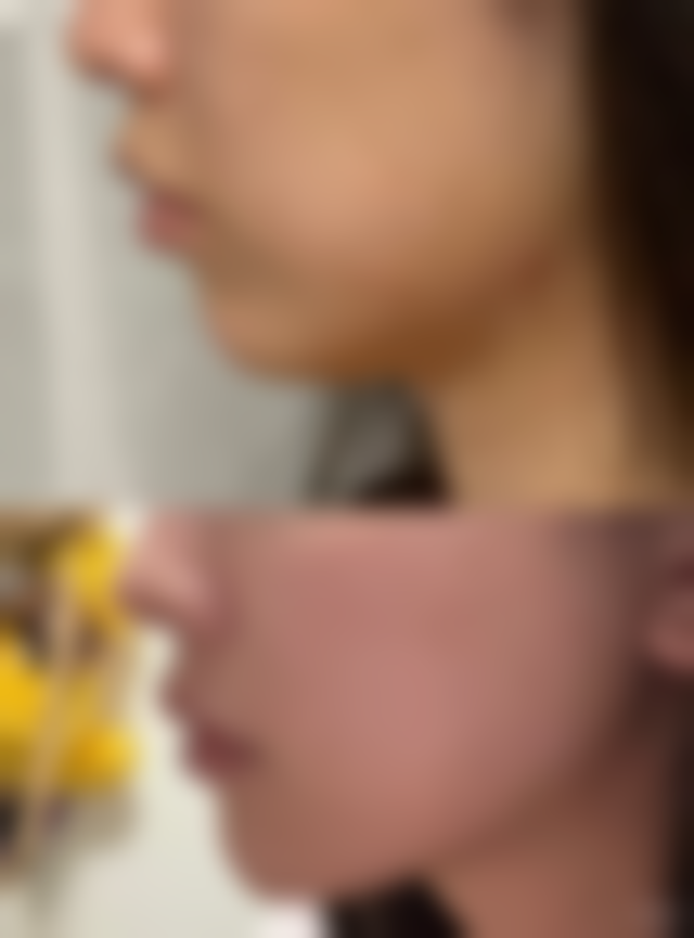 六、深圳大学总医院是三等甲吗?国有背景的安心保护