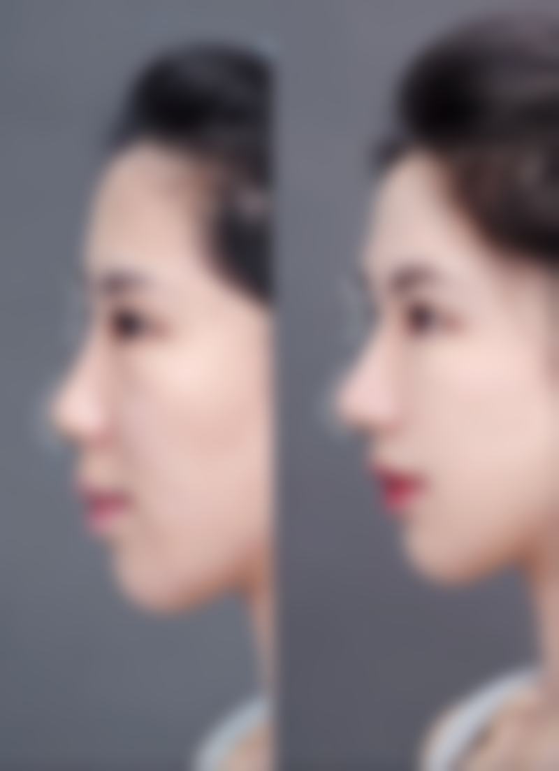 如何判断报价是否合理及避坑指南