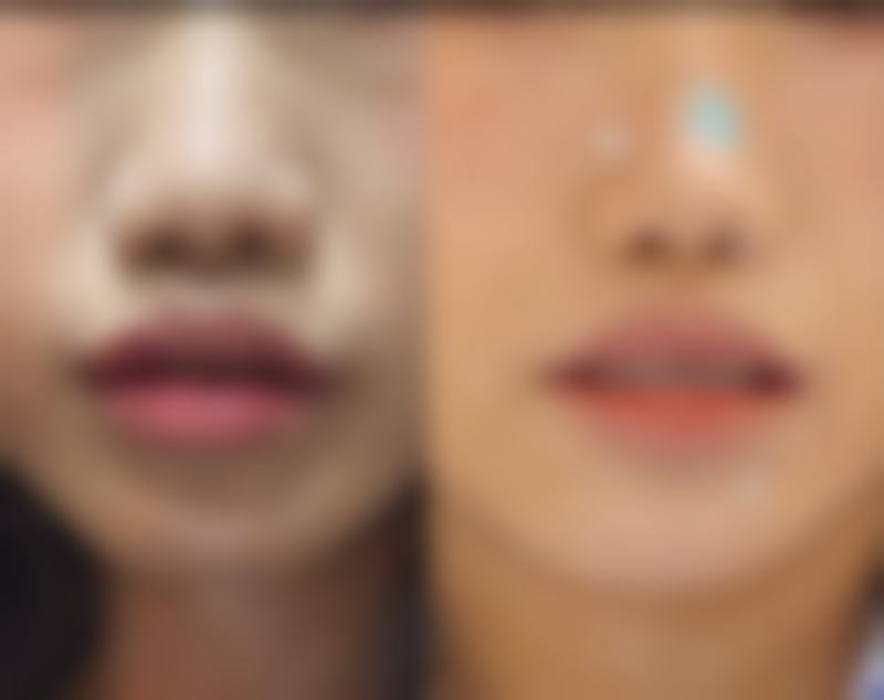 广州唇部整形医院排名前十名：里头哪家是三甲且收费合理的靠谱医院呀？ 