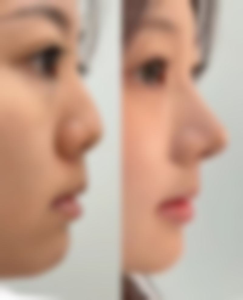 杭州天鑫医美地址在哪里？交通便利好找吗？