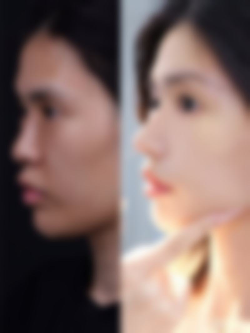 深圳富华医疗美容医院预约挂号与变得更美指南:轻松预约,科学变得更美