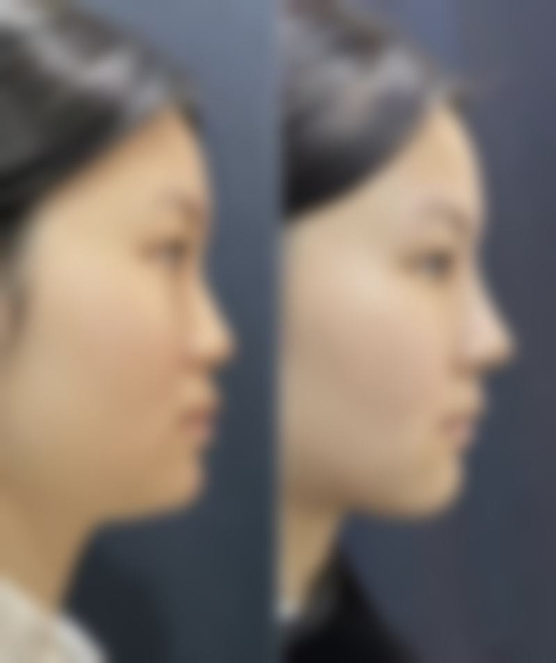 成都军大整形外科医院哪个医生好？蒲小兵吸脂、杨勇隆鼻、张雪峰隆胸，正规医院更放心