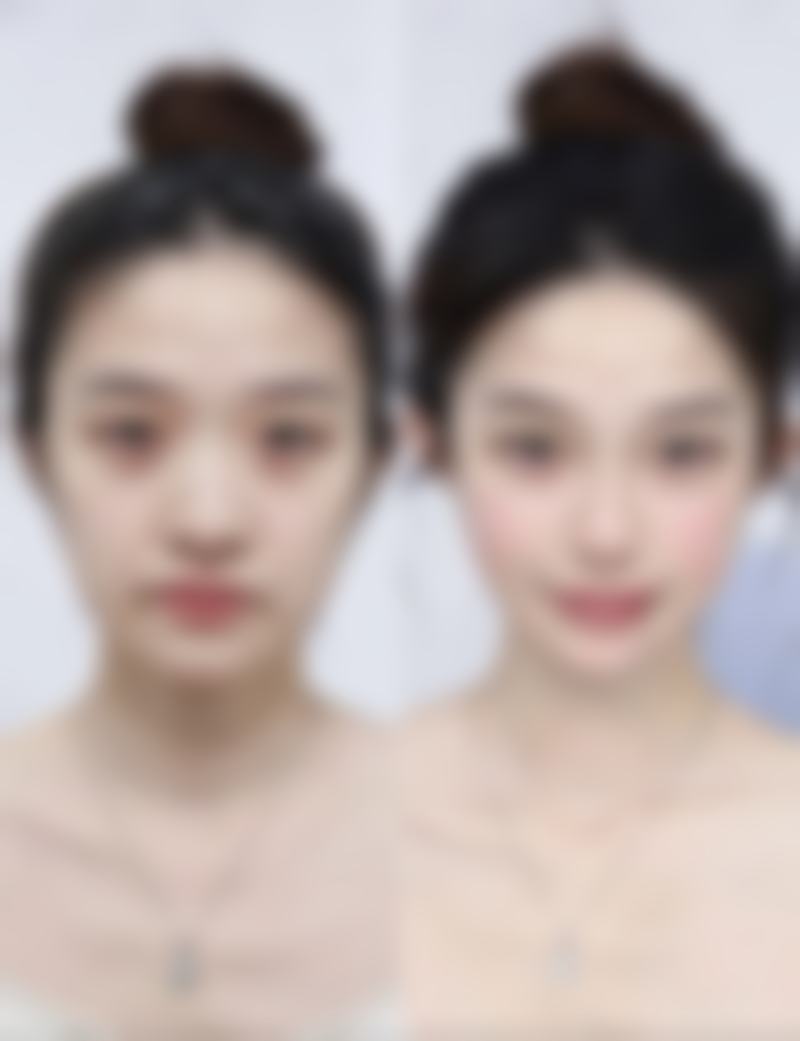 杭州天鑫医美医院价格表:透明收费,高性价比之选