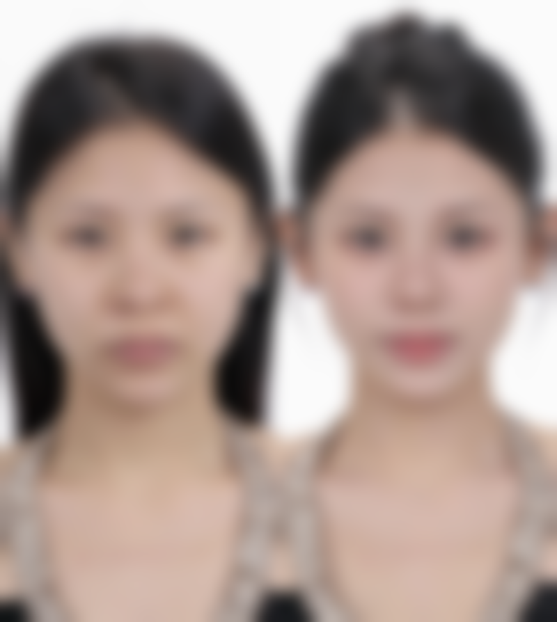 2026年西安私密修复项目收费情况（做私密修复需要多少钱？）