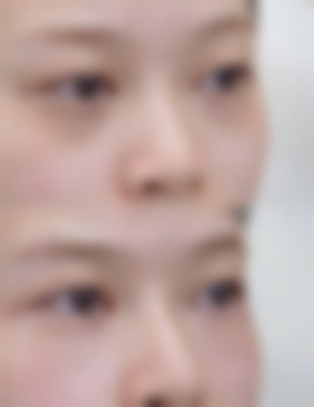 五、价格迷雾如何破?在天佑医院做医美,费用透明吗?