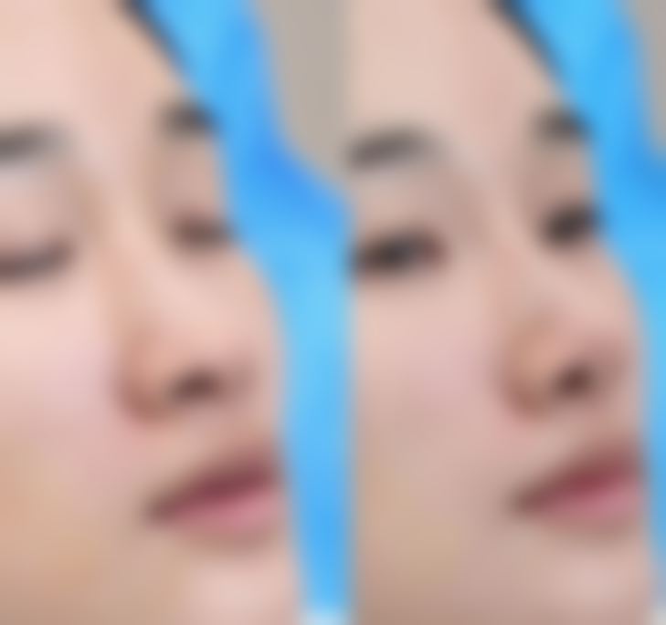 潮州市保丽圣美医疗美容医院特色技术及优质服务