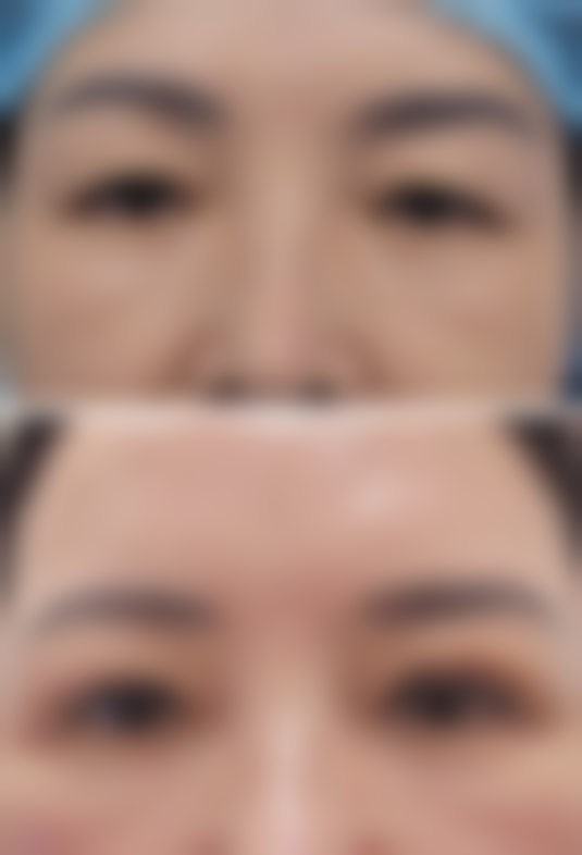 四、榜首PK 3：杭州建国医院整形美容中 心——技术扎实可靠的“实力老将”