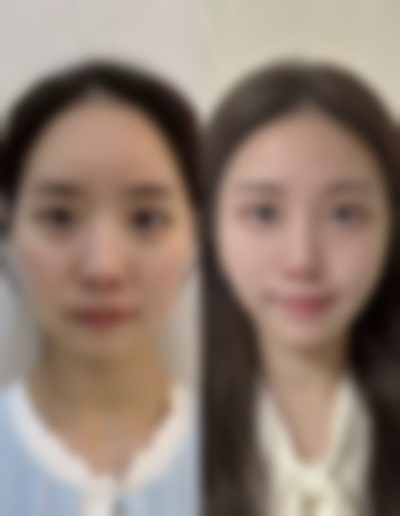 邓娟娟30年私密整形经验,技术优势体现在哪里?