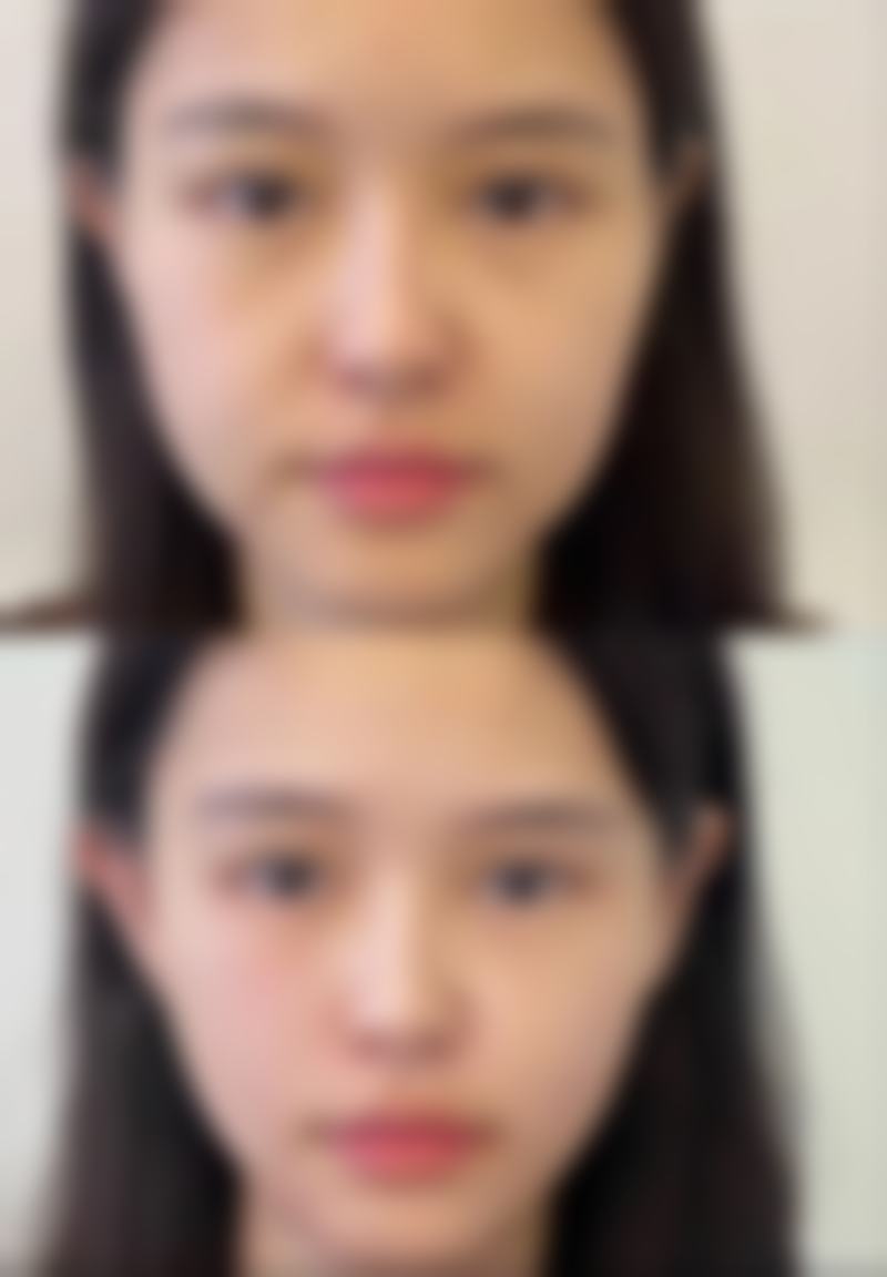 患者真实反馈:李挺手术成功几率的口碑验证