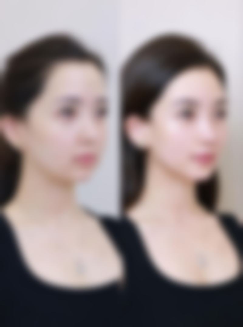 4、北京7d聚拉提医院：北京彤美医疗美容医院