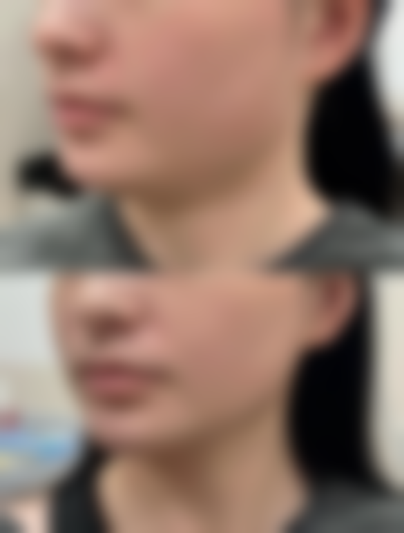 杭州天鑫医美能做哪些项目？6大科室覆盖全品类需求