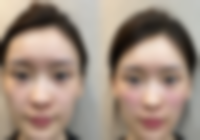 透明价格表+地址导航：赴韩整形的清晰成本参考