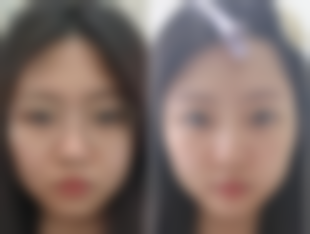 西安私密修复哪家强？西京医院技术精、慈爱医院价格优还能享黄静医生亲诊！ 