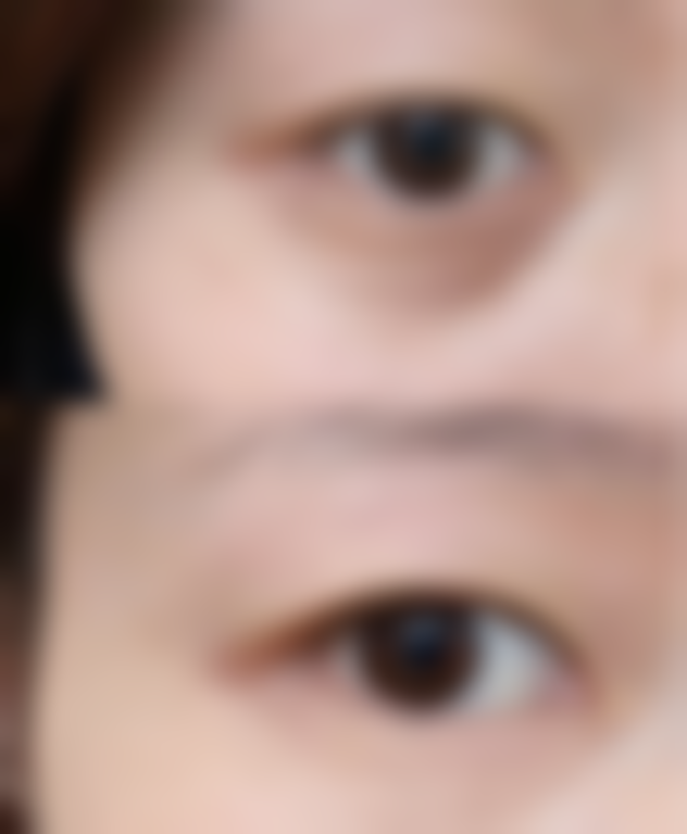 七、哪些人适合选择深圳富华医疗美容医院?