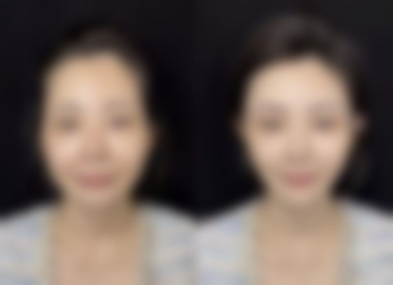 为什么成都私密整形患者更信赖李挺医生?成都整形骨干医生口碑评价如何?