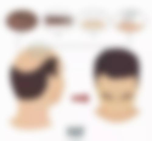 杭州欧洲之星十大医院排行揭晓！杭州时光医美案例多护理优，浙大一院有福利还能线上约