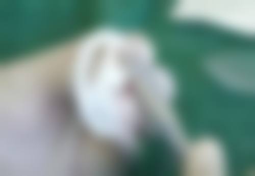 郑州玻尿酸额头去皱医院哪家好？郑州美莱整形/郑大五附院医美！透明质酸注射医生亲诊，自然饱满