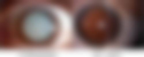 1、蚌埠蚌山区人民医院怎么样？医院简介如下：