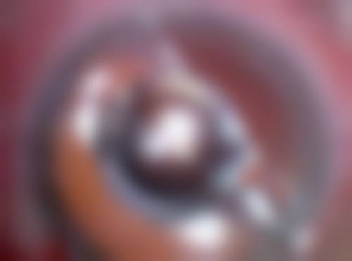 4. 北京美尔目医院医疗美容科设备仪器