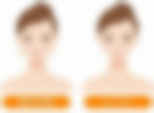 三、核心技术:揭秘唐春华院长的阴道紧缩手术是如何进行的?