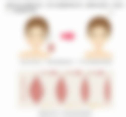 2. 排名前列:广州曙光医学美容医院——老牌机构的“稳妥之选”