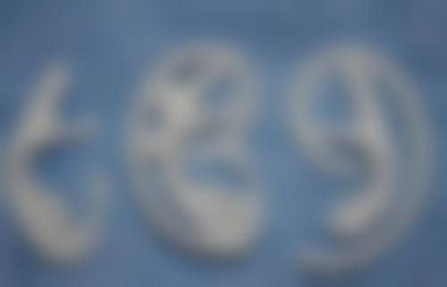 深圳畸形耳朵整形——全包耳再造价格明细