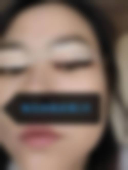 深圳整形医院排名第一名:深圳美莱医疗美容医院