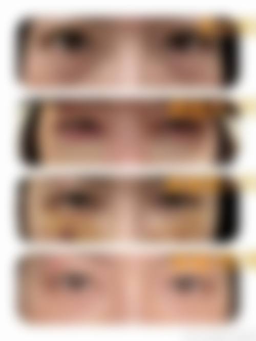 ✅韩国优雅人免费预约挂号：赴韩面诊必备攻略，避坑不踩雷