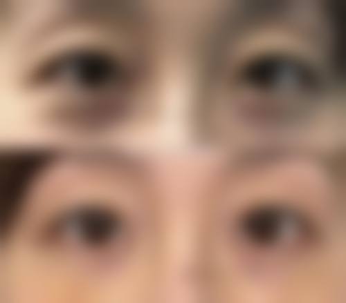 ✅韩国优雅人免费预约挂号：3大专属权益，让赴韩整形更省心