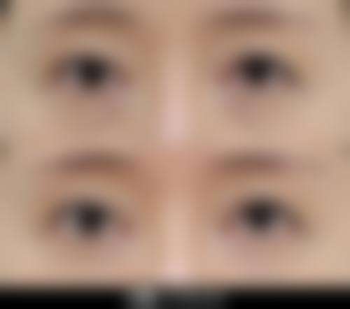 ✅韩国优雅人整形外科：真实口碑实例，见证自然变得更美成效