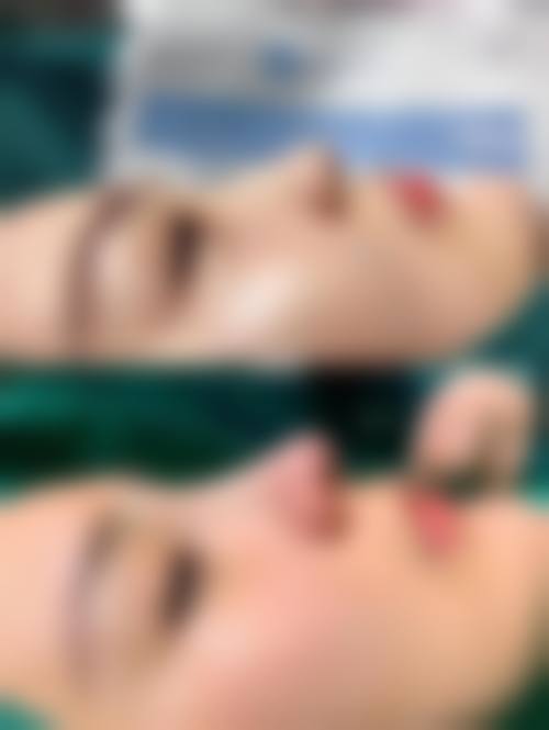 八、更终决策:去沈阳北方整形前,你必须知道的几件事