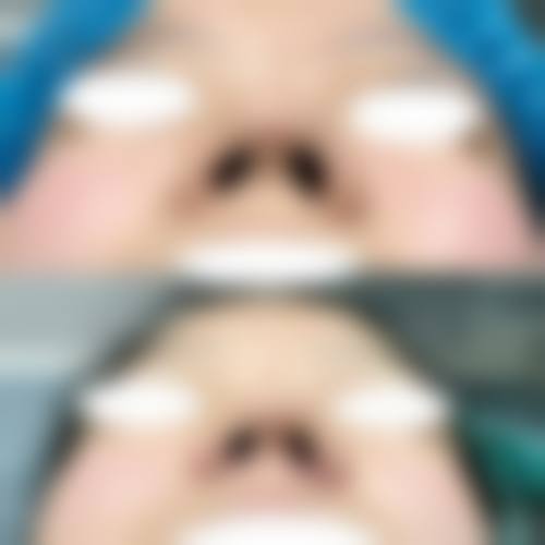 五、东莞丽星医疗美容诊所价格表区间/收费标准说明