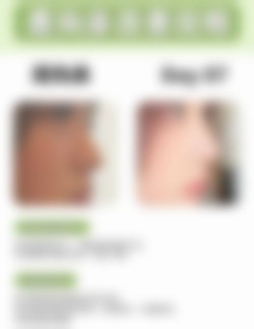 真实修复过程与不适时间线