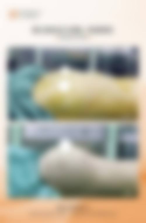 郑州面部悬吊筋膜提升医院排名前十的医院价格如何？