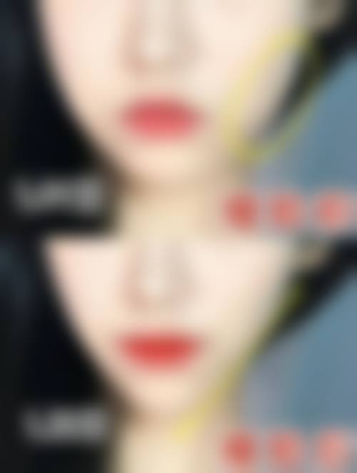 四、杭州连天美整形医院全品类塑美项目,覆盖不同求美者需求